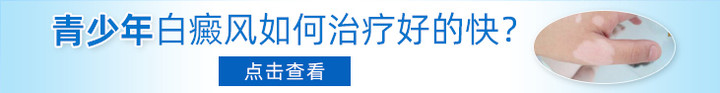 抚州治疗白癜风医院